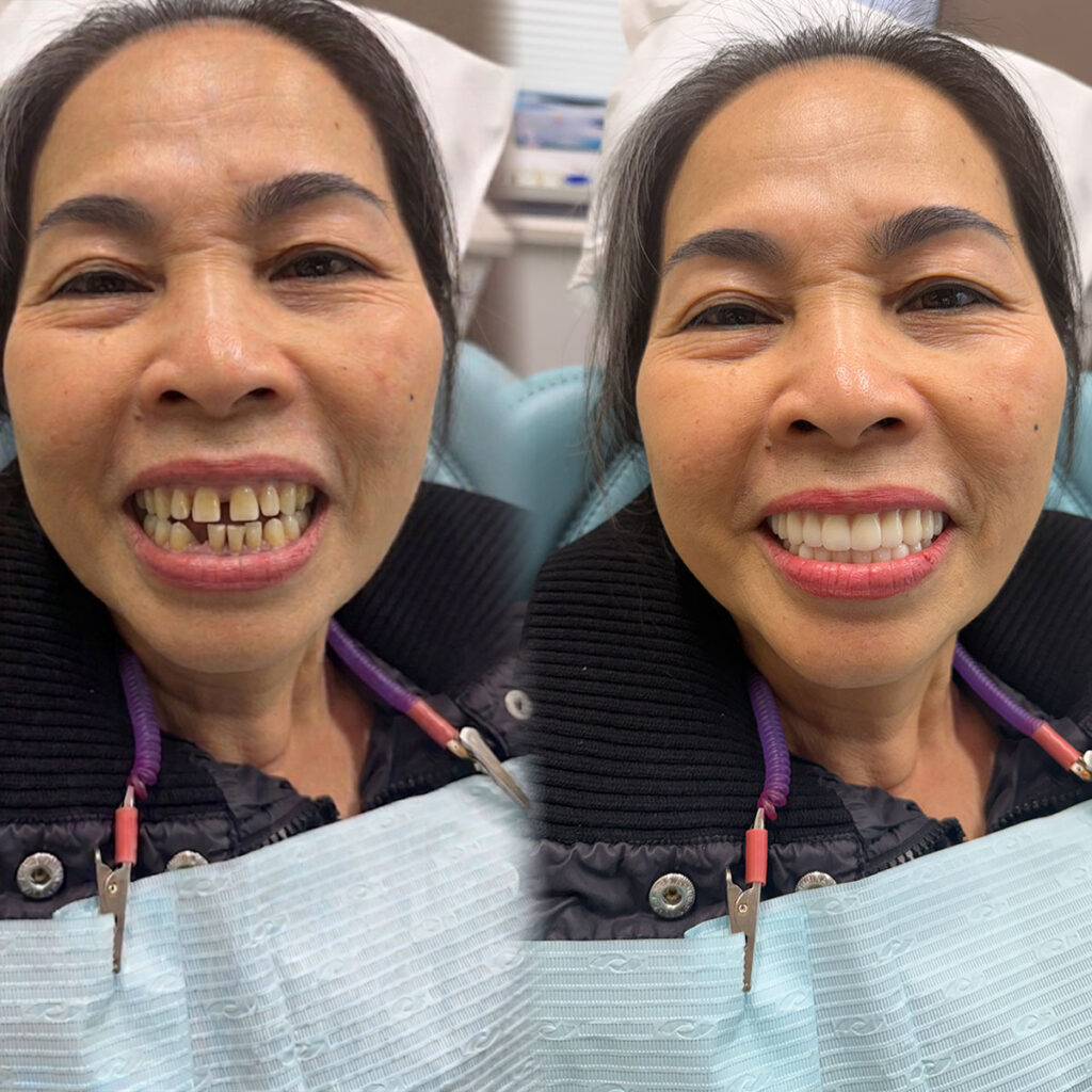 before and after procedure image results