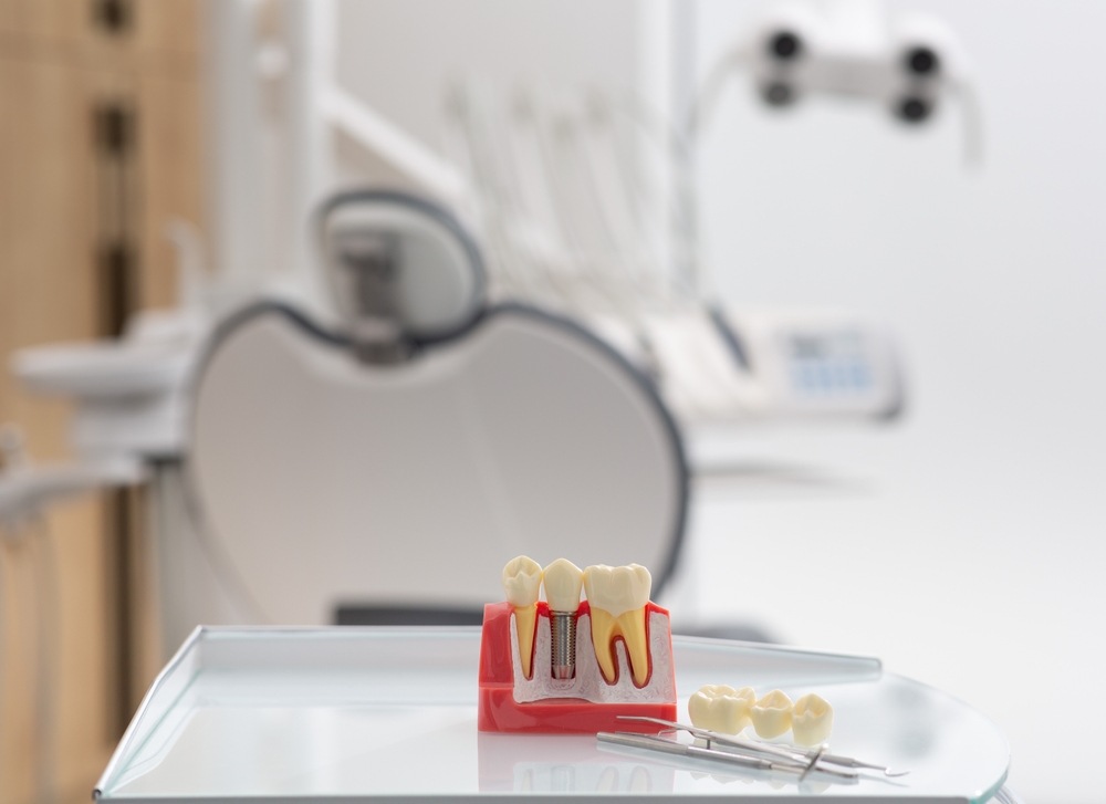 A close up image of a healthy, bright white tooth implant in a patient's mouth. No text on the image.